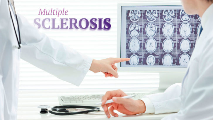 Stem Cell Therapy for Multiple Sclerosis MedAdvisor